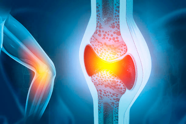 Prevención de enfermidades articulares